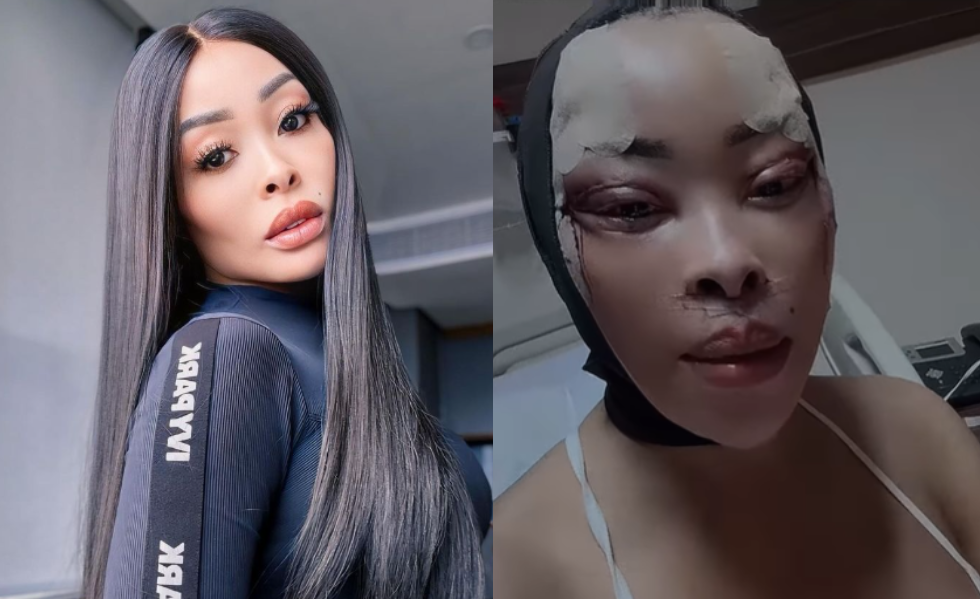 khanyi mbau skin lightening glutathione injections I grew tired of Botox and fillers' — trends after undergoing surgery again cookie-butter-latte Body Detoxification Largo FL Pack:Mini 30GM