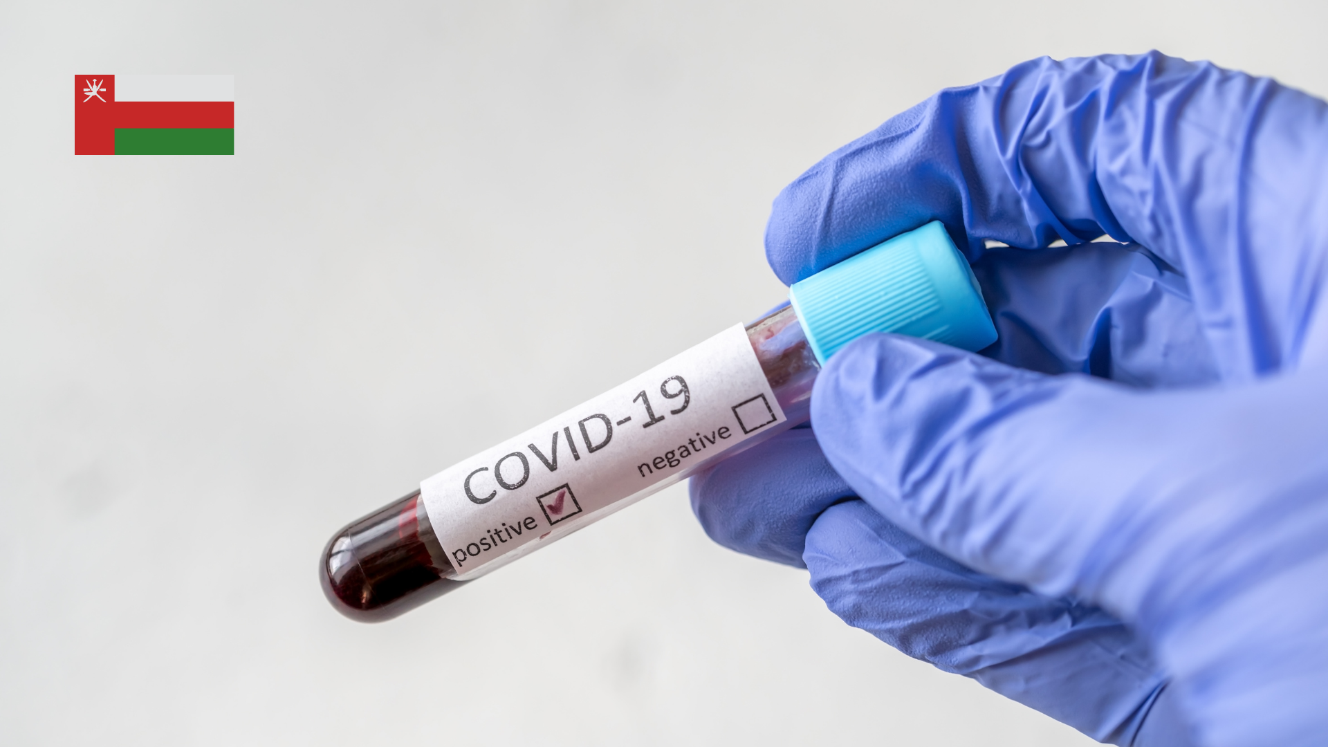 هل بدأ الانحسار مع أرقام كورونا المُعلنة اليوم؟