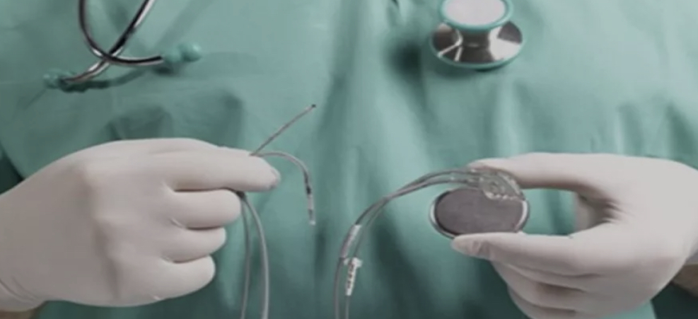 اختصاصي يوضح حول استخدام جهاز منظم دقات القلب للأطفال