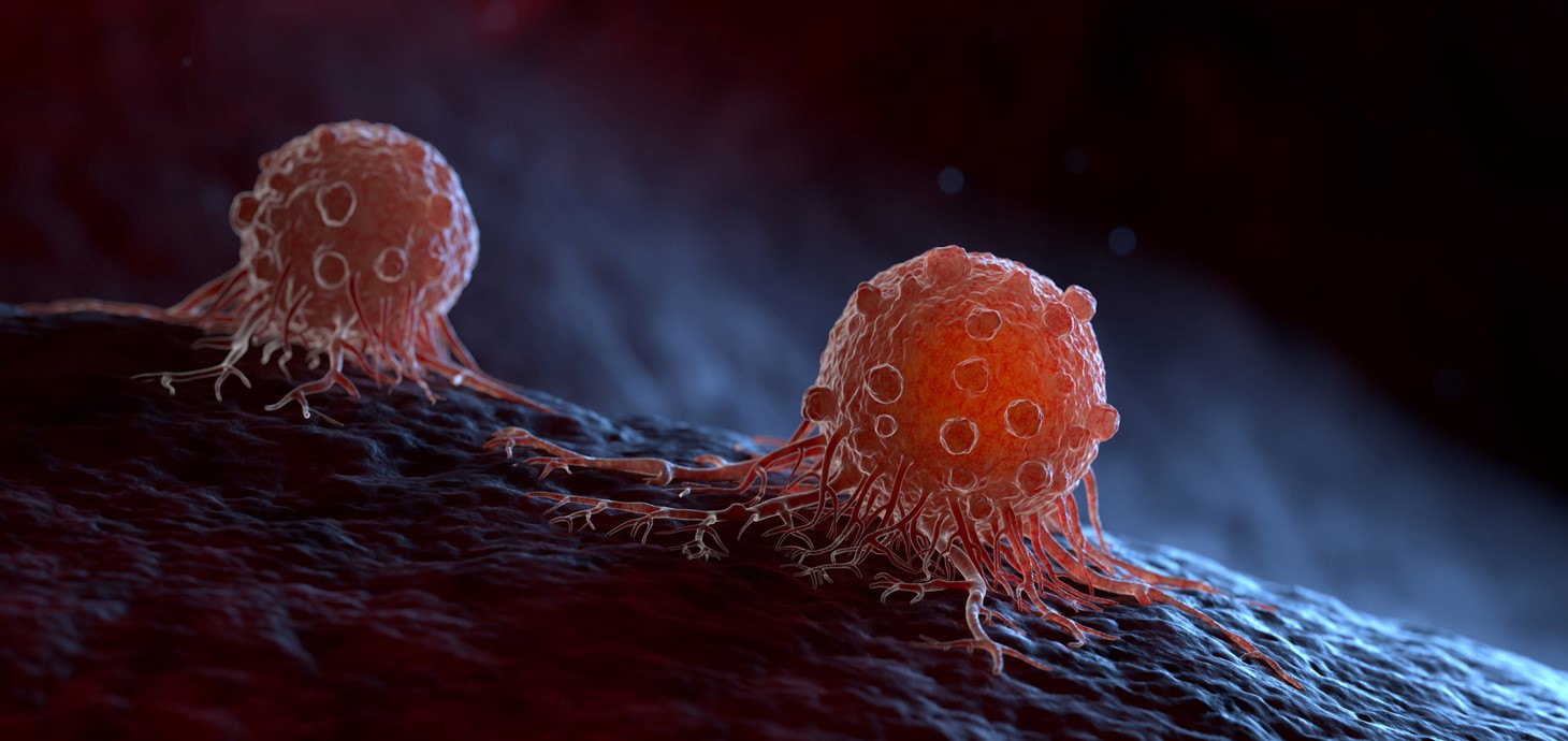 احذري من المرض المعروف بـ “بالقاتل الصامت”