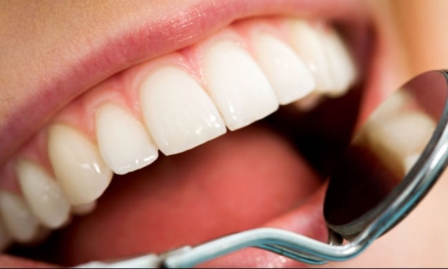 5 خطوات للعناية بأسنانك يشرحها لك طبيب مختص