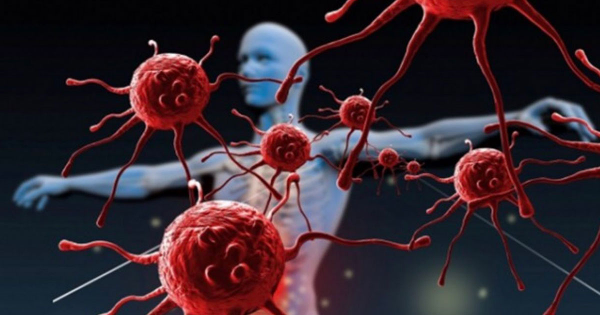 السلطنة الأول خليجيا في نشر معدلات السرطان والسعيدي يؤكد: ليس أمرًا مقلقًا لكن لا ينبغي التساهل