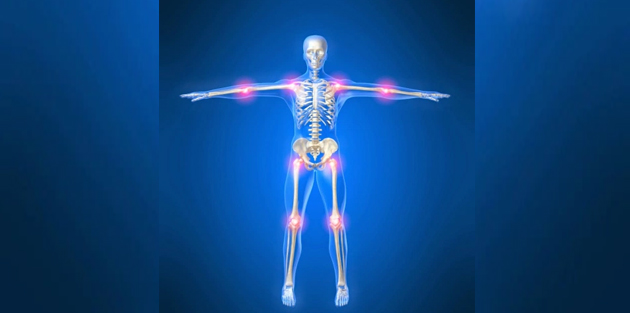 نتائج لدراسة حديثة تُبشِّر الذين يُعانون من التهاب المفاصل