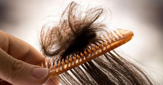 تعد حالة غريبة ونادرة: ماذا تعرف عن متلازمة الشعر غير القابل للتمشيط؟