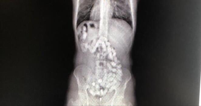 مواد ممنوعة بداخل أحشاء شخص في مطار مسقط