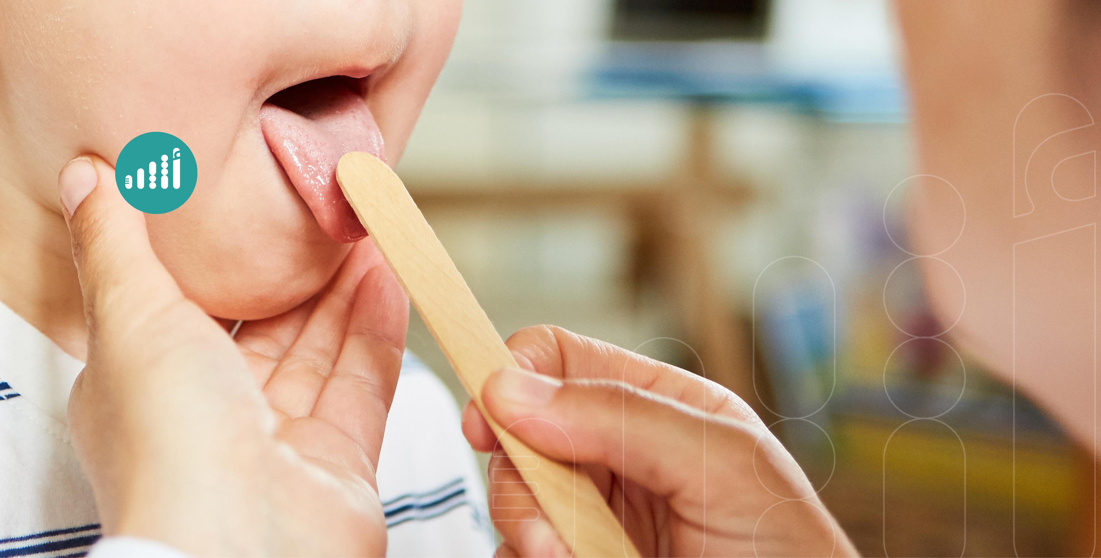 لا تُهمِل التغيّر في لون لسانك؛ فله دلالات صحية مهمة