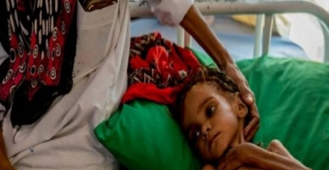 د.عبدالله باحجاج يكتب: اليمن، من لم يُقتل من أبنائه بصاروخ أو قذيفة ، قُتِل بدم بارد ، وهؤلاء هم المجرمون .