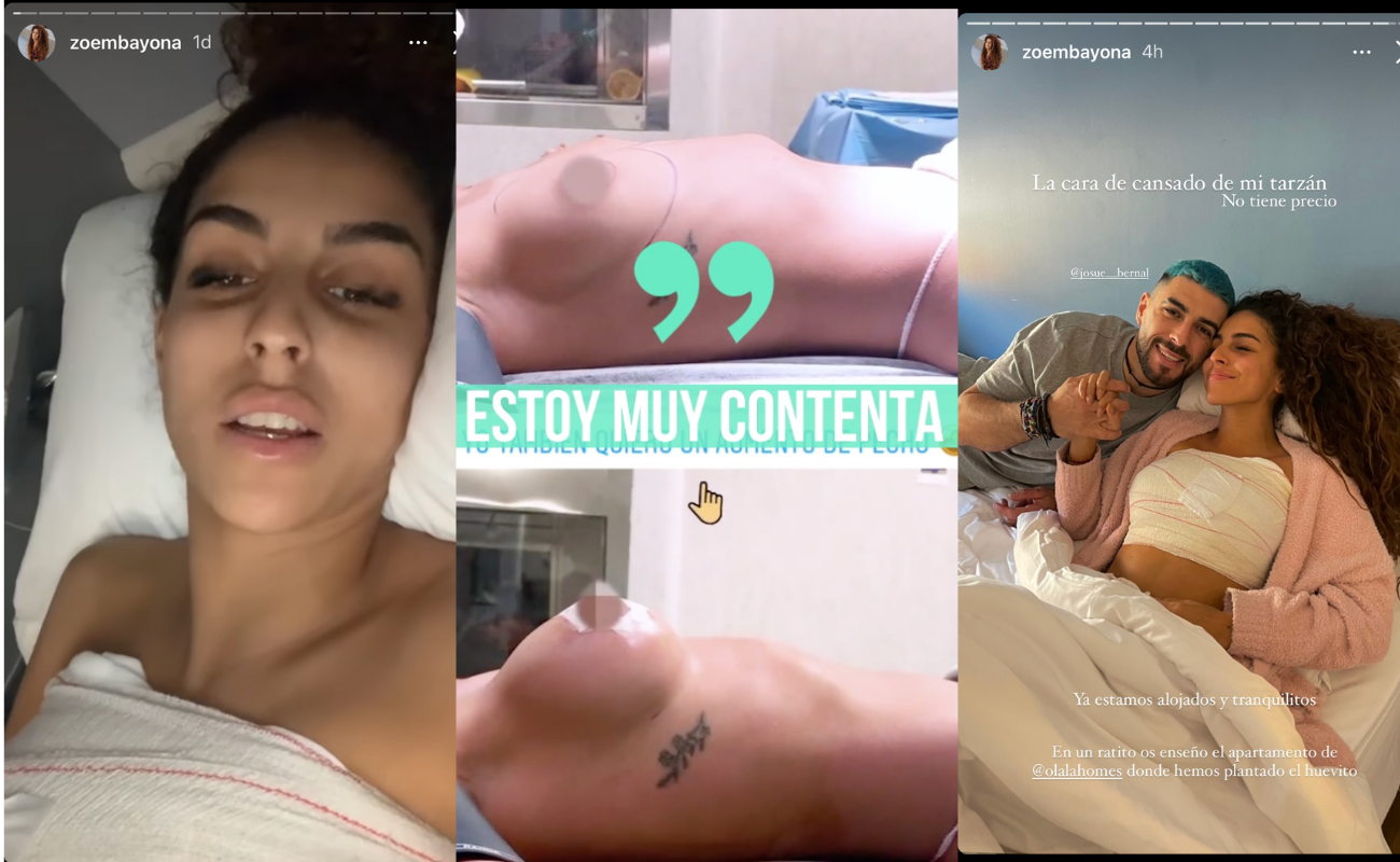 Zoe muestra el resultado de su operación de pecho: “Estoy muy contenta” -  Tikitakas