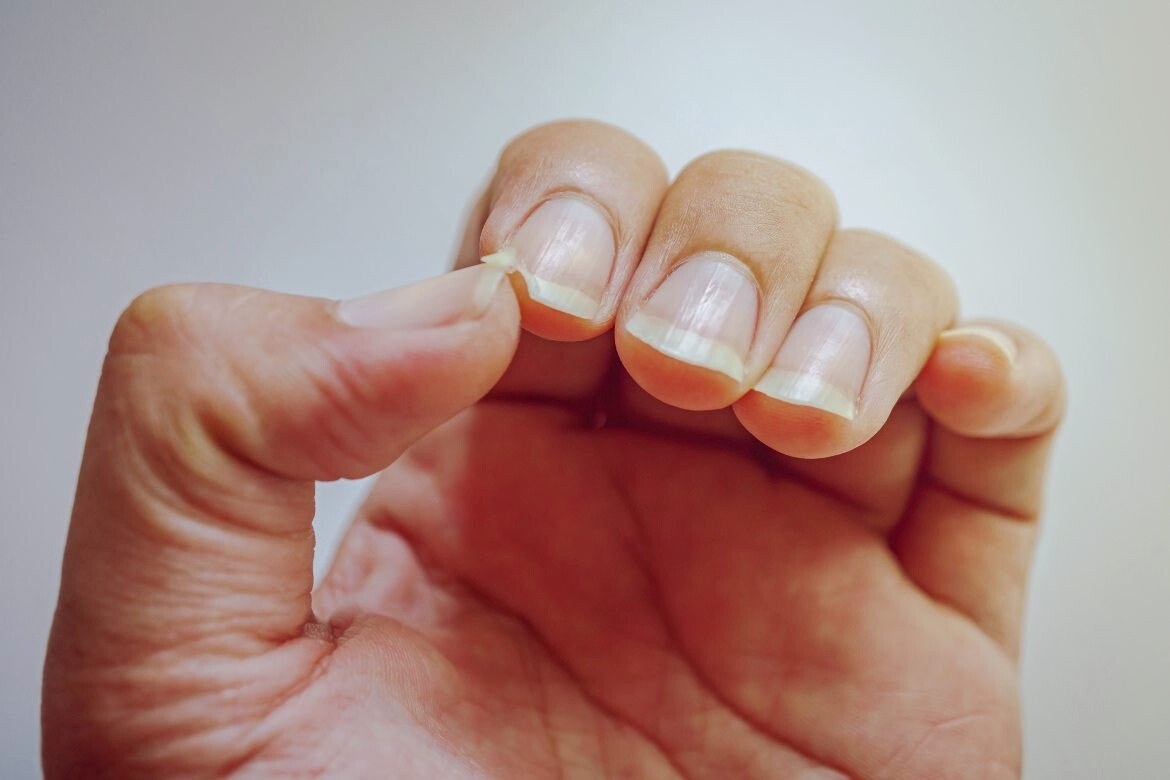 Should I Take a Vitamin for Brittle Nails? - The New York Times