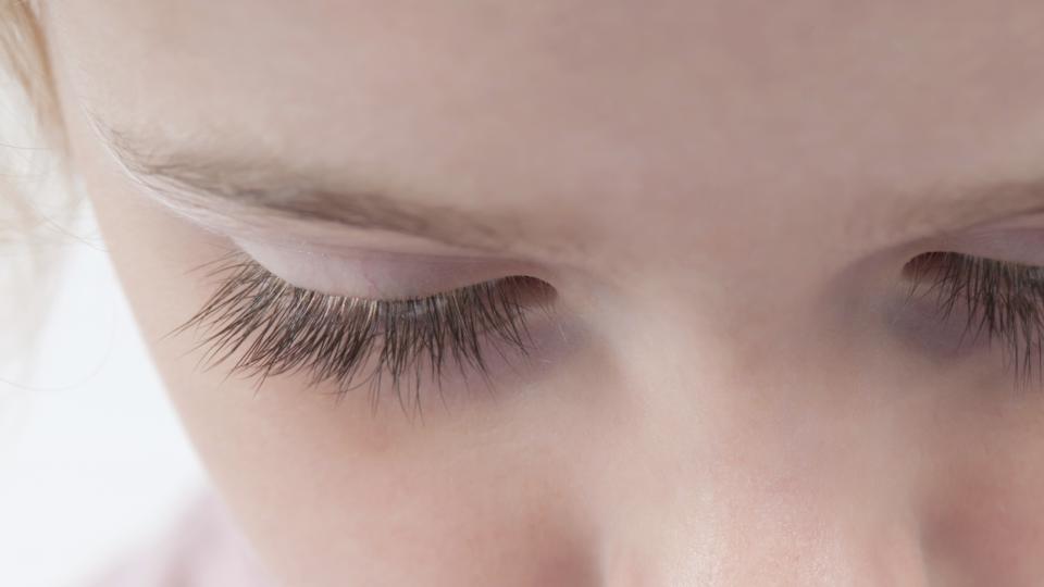 Ask the Expert: My daughter pulls out her eyelashes – The Irish Times