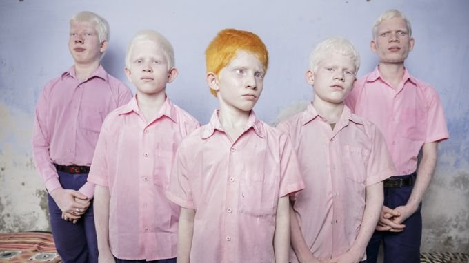 1er prix "People-Portraits single" : cette photo prise en Inde, le 25 septembre 2013, dans une école accueillant des enfants albinos et aveugles.  
