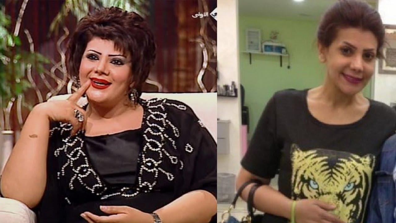 الممثلة الكويتية إلهام فضالة بعد إجراءها لعملية تصغير المعدة استطاعت التخلص من وزنها الزائد
