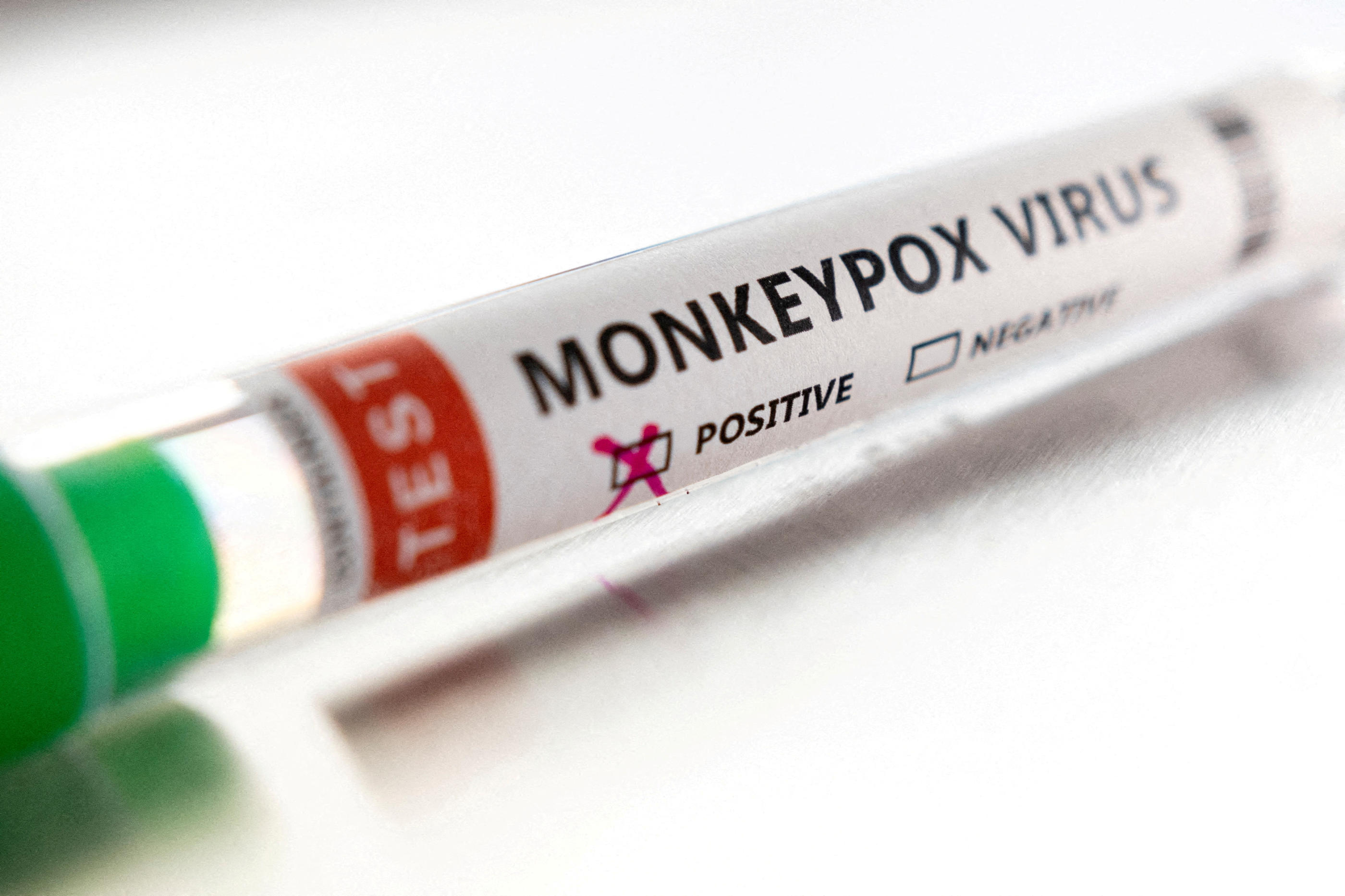 L’Agence Régionale de Santé (ARS) Île-de-France informe de la survenue d’un premier cas confirmé de monkeypox (variole du singe) chez un enfant scolarisé en école primaire. REUTERS/Dado Ruvic