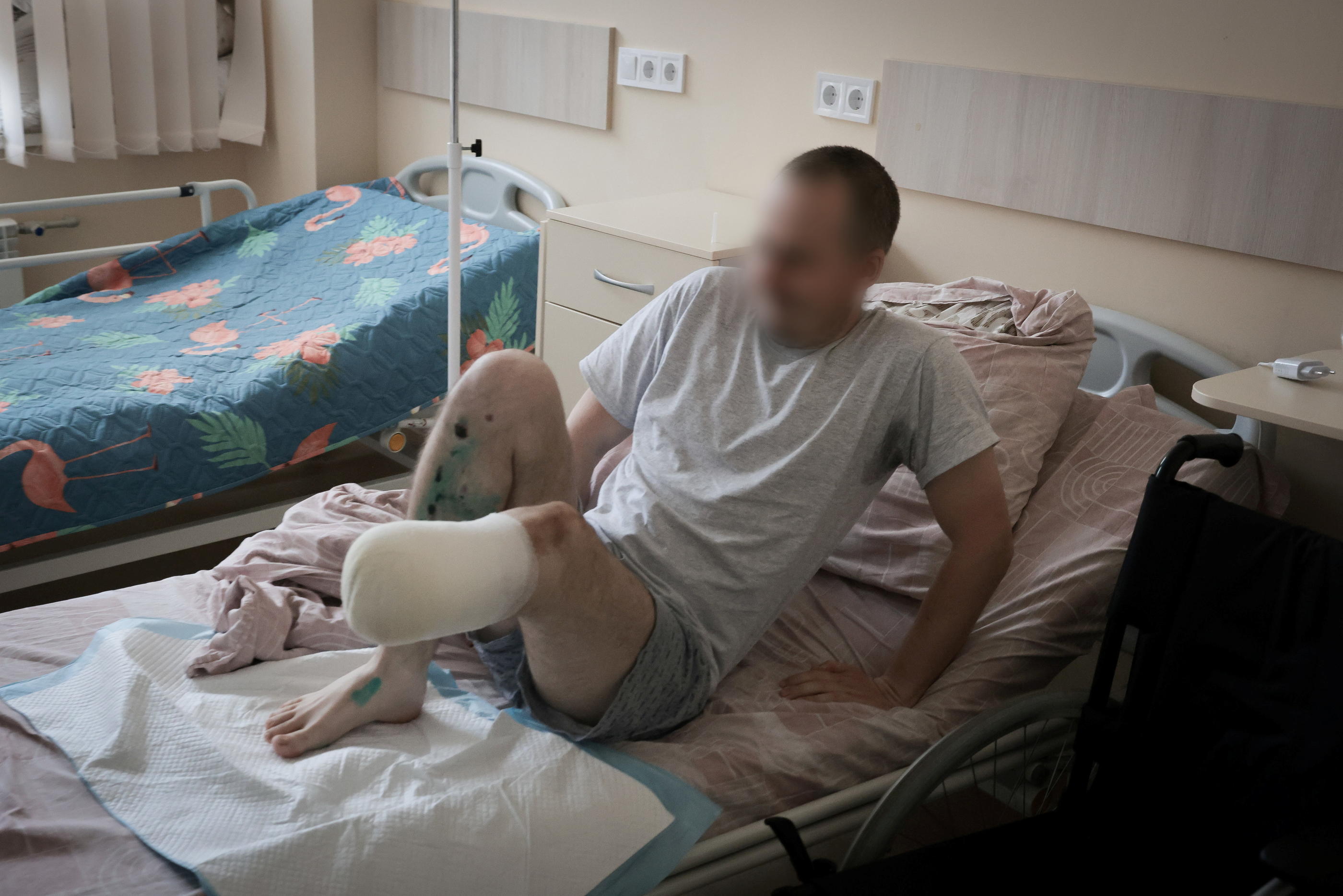 Après son accident, Vadim, mobilisé dès le début du conflit, a été pris en charge à Kramatorsk puis à Dnipro, où il attend une prothèse pour sa jambe gauche. LP/Philippe de Poulpiquet