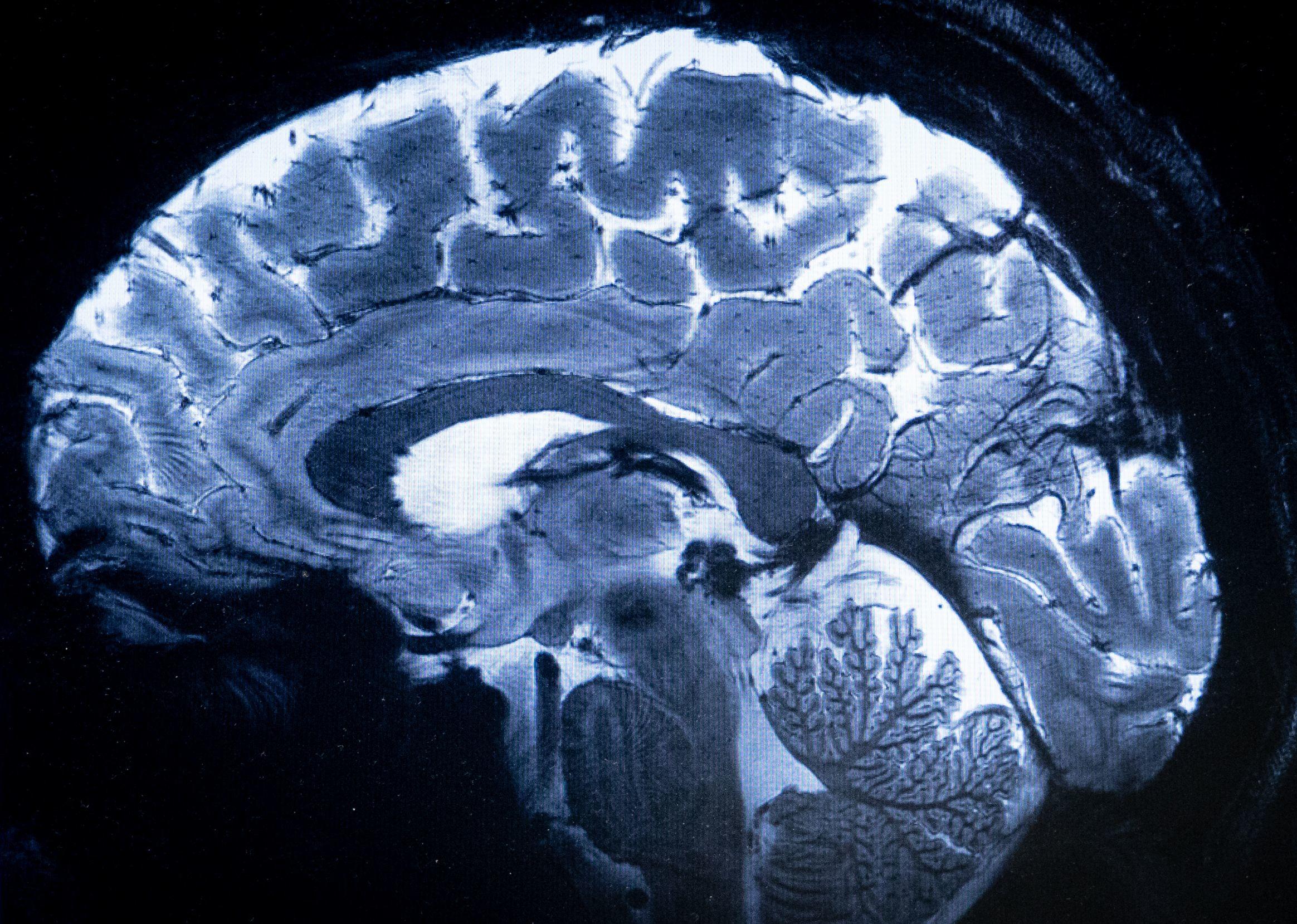 Les résultats obtenus en « scannant » un cerveau humain pendant quelques minutes sont beaucoup plus précis qu'un examen avec des IRM installés dans les hôpitaux. AFP/Alain Jocard