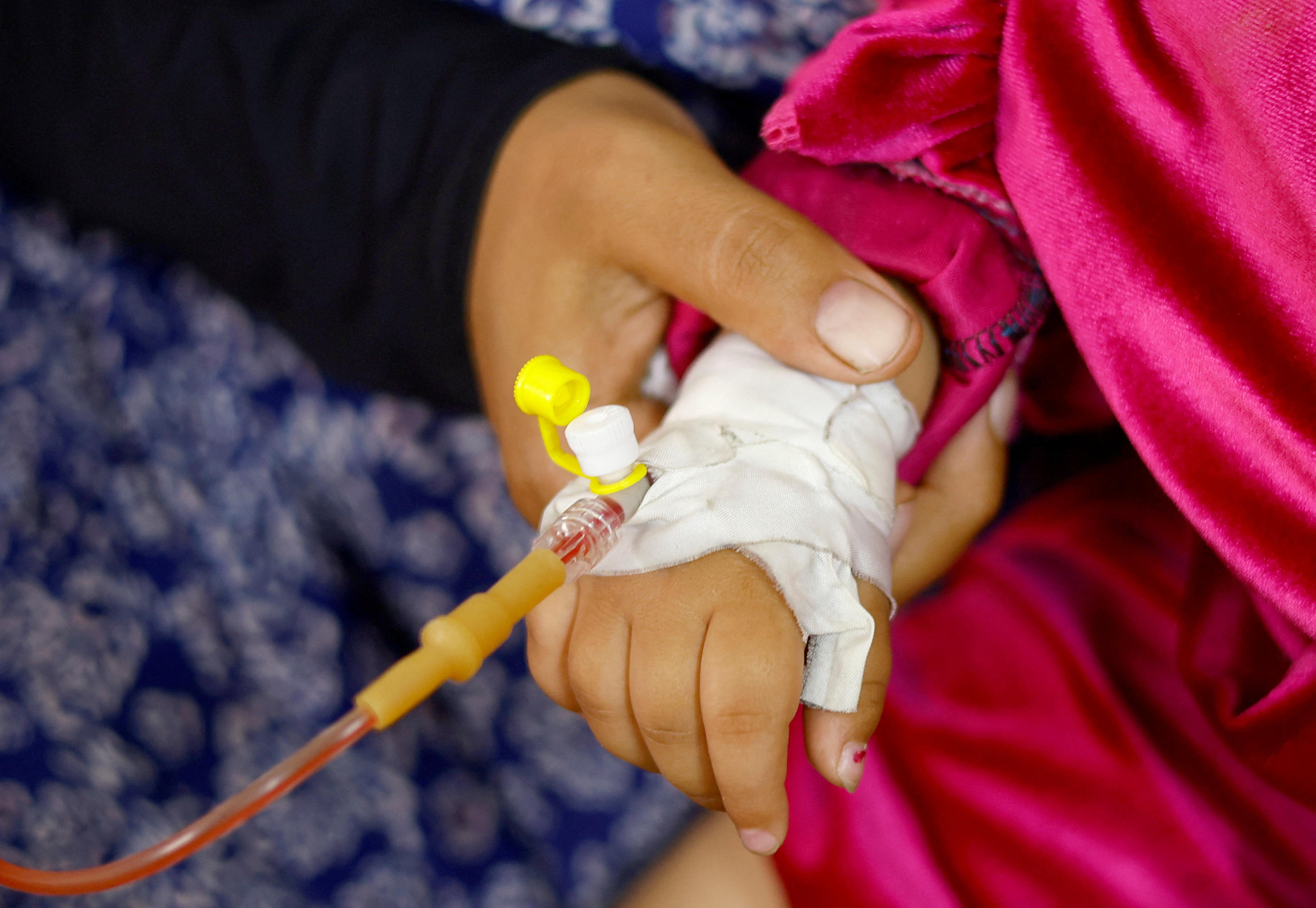 Une fillette souffrant de malnutrition est soignée à l'hôpital al-Awda, dans le Nord de la bande de Gaza. Reuters/Mohammed Salem