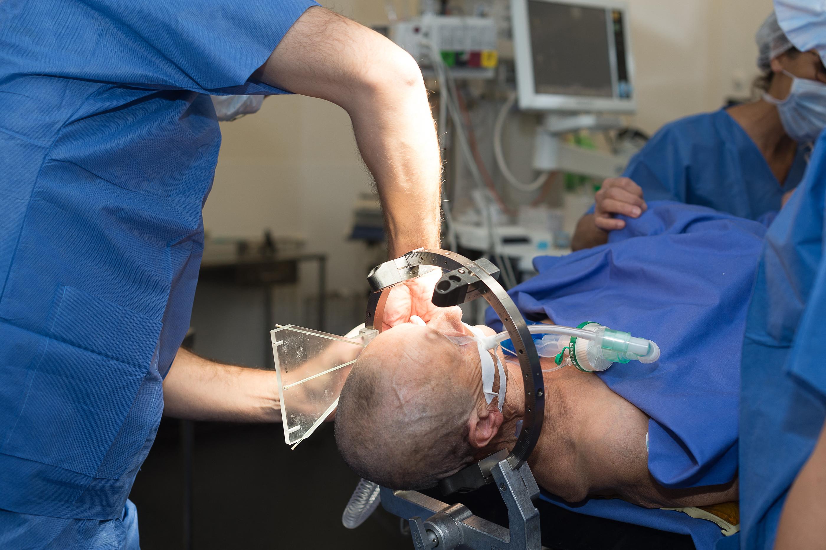Une stimulation cérébrale profonde réalisée à l'hôpital Pasteur de Nice (Alpes-Maritimes). AFP/BSIP /A. NOOR