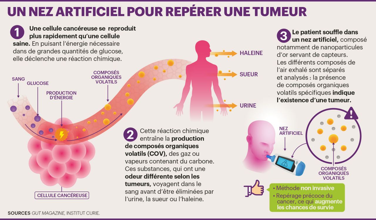 Santé : détecter le cancer à l'odeur - Le Parisien