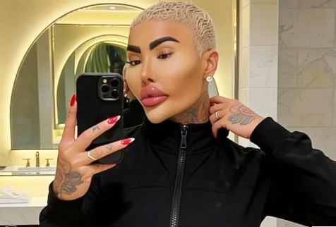 Jordan James Parke, l'influenceur qui a dépensé plus de 120 000 euros pour  ressembler à Kim Kardashian, est mort à l'âge de 34 ans - Le Parisien