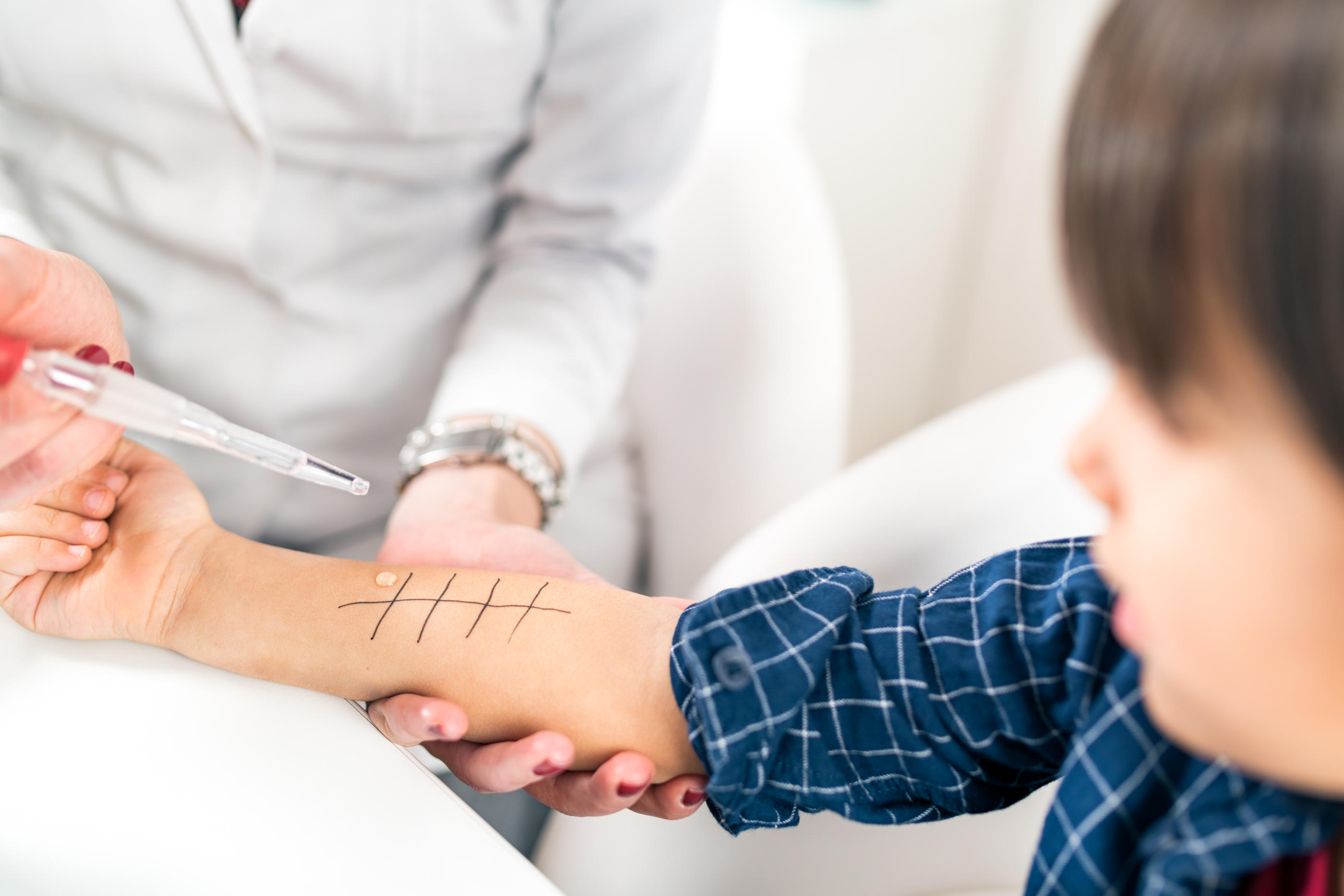 Quand l'allergie se produit après un repas complexe contenant plusieurs nutriments, une enquête alimentaire, ainsi que des tests cutanés sont nécessaires. Istock/Microgen

test allergie

enfant