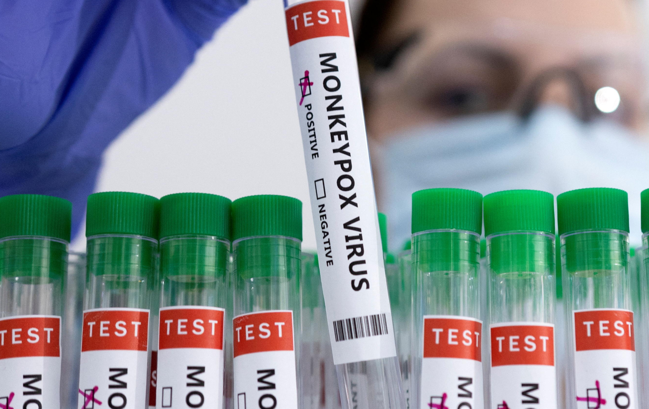 Plus de 180 malades de la variole du singe ont été recensés en France à la mi-juin. Reuters/Dado Ruvic