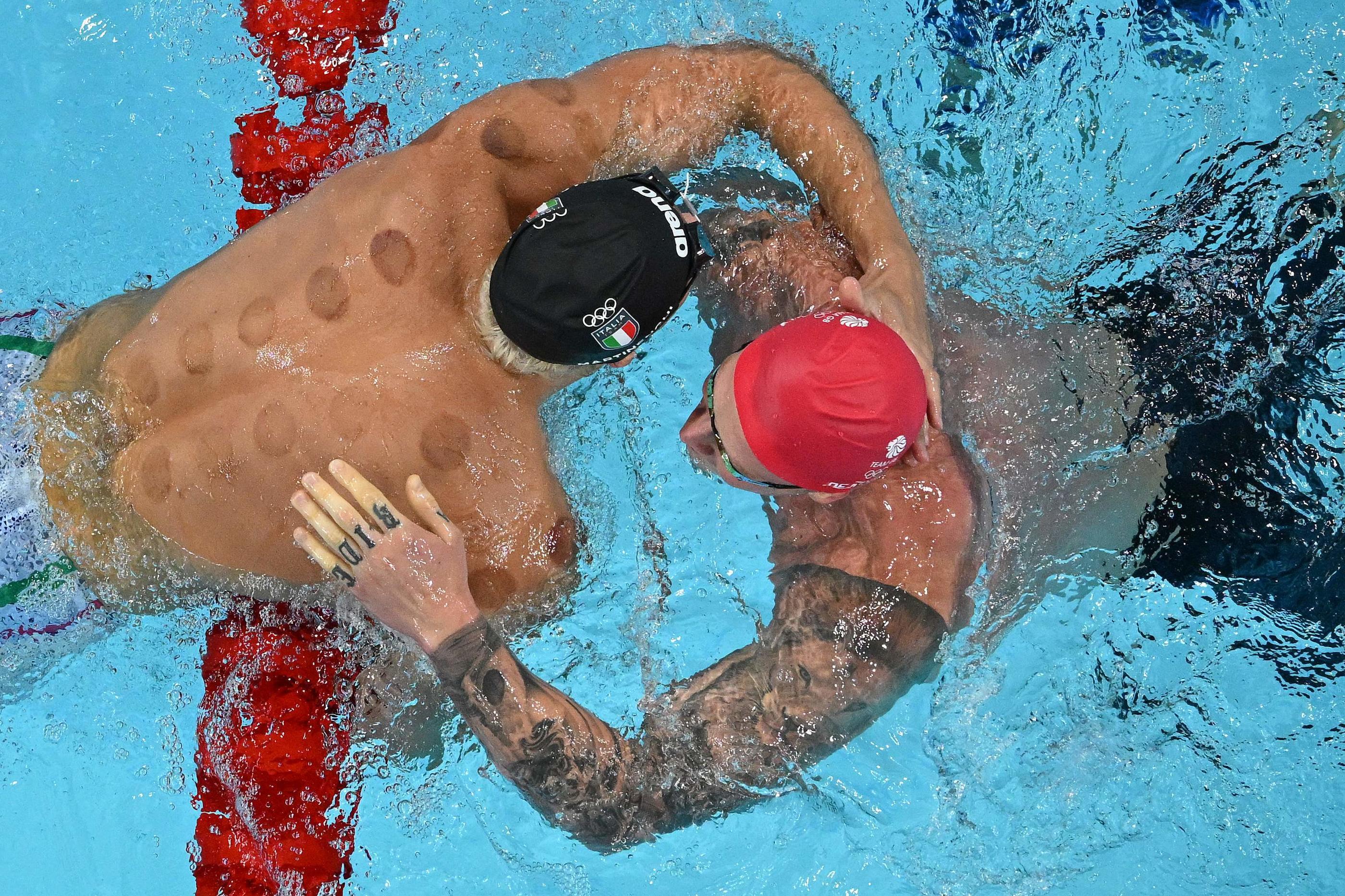 La ventousothérapie consiste à appliquer des ventouses sur le corps pour aspirer la peau dans le tube, et ainsi faire circuler le sang. À gauche, le nageur italien Nicolo Martinenghi porte les fameuses marques sur son dos. AFP/François-Xavier Marit