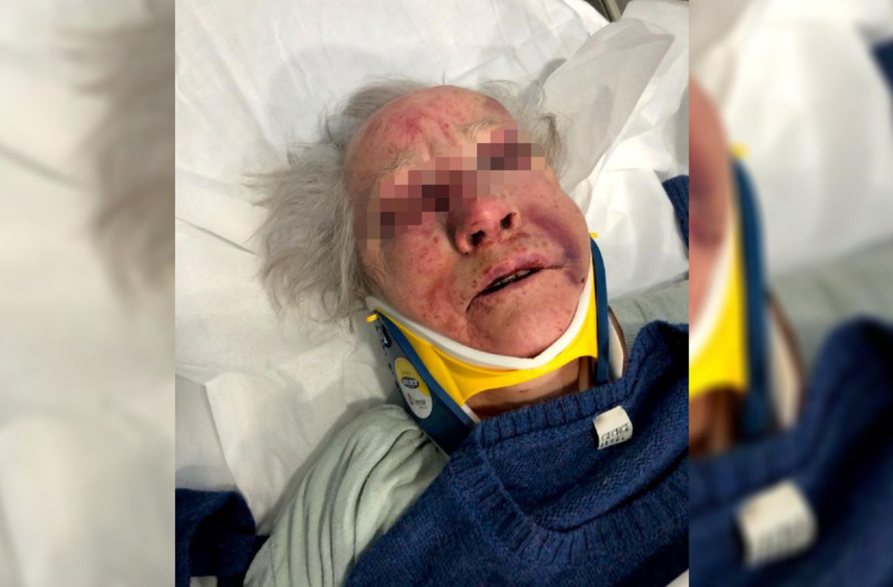 <b></b> Agnès, 85 ans, a été agressée chez elle par trois hommes qui se sont introduits de force.