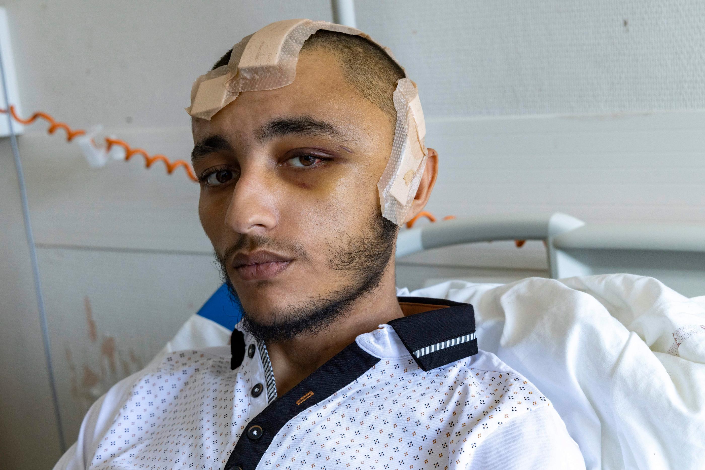 Ils ont opéré un mort » : comment les médecins ont sauvé Hedi en lui  enlevant une partie du crâne - Le Parisien