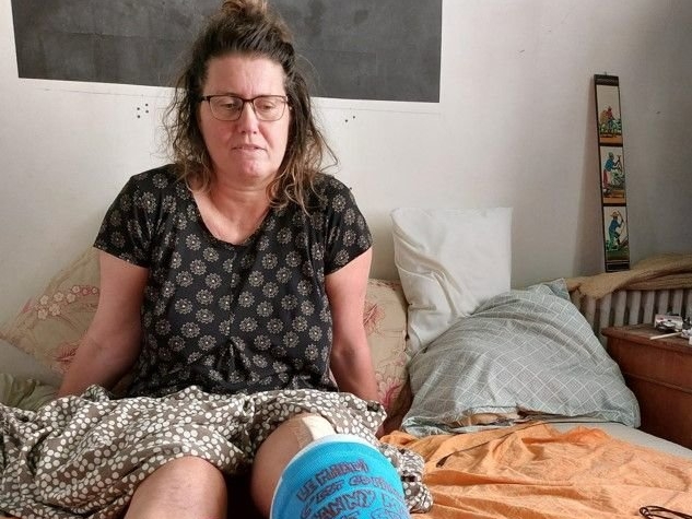 Villetaneuse (Seine-Saint-Denis), le 15 juillet 2023. Caroline C., professeure des écoles, souffre d'une double fracture à la jambe gauche. LP/N.R.
