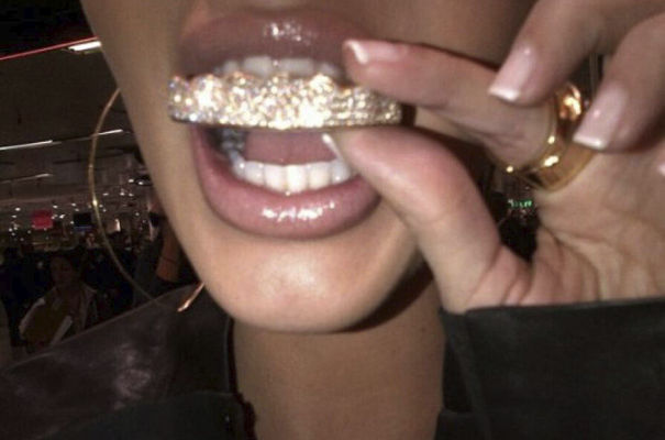 Le grillz : un accessoire dentaire bling-bling