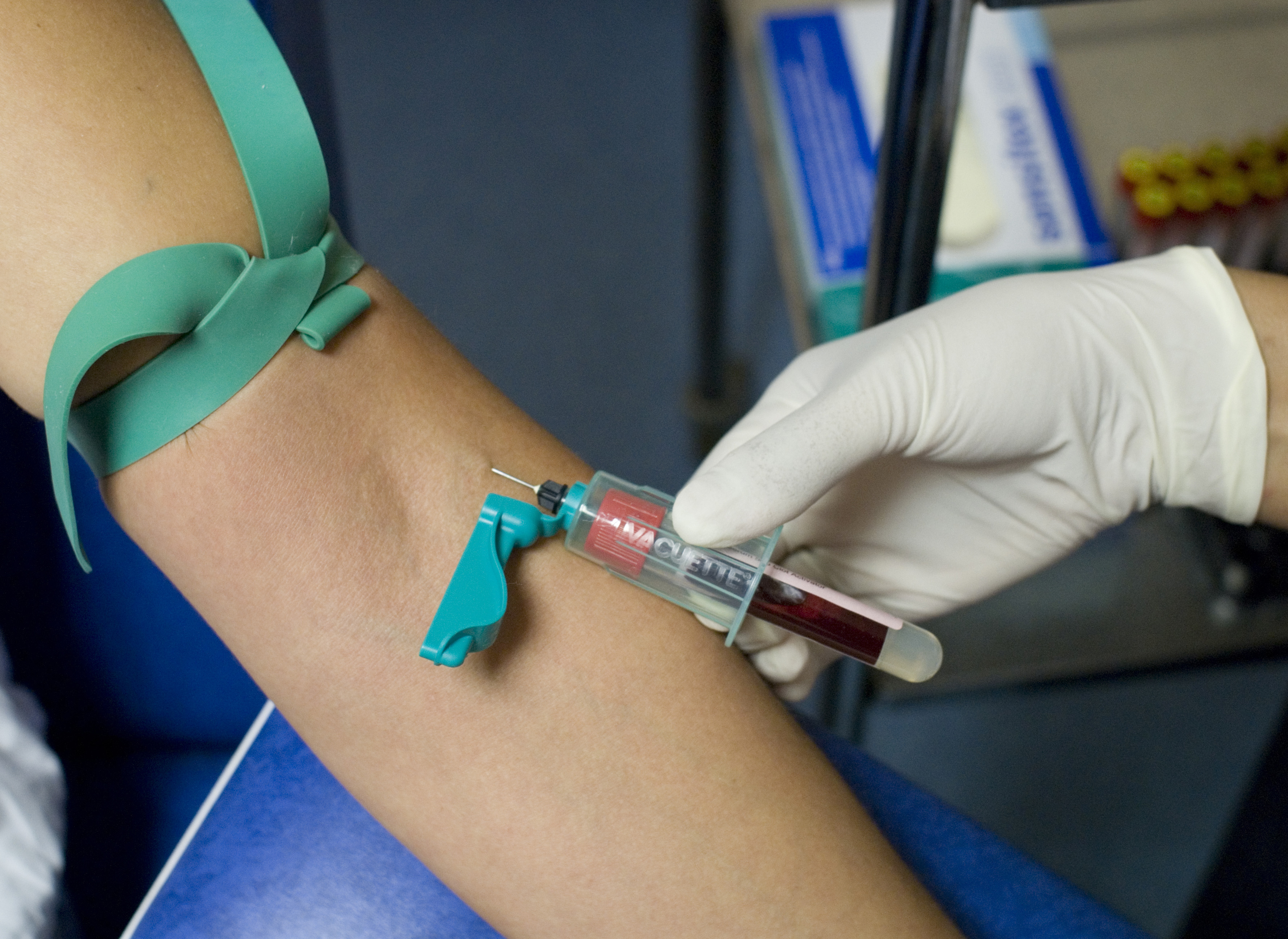 Un traitement préventif injectable pour réduire le risque de transmission  du VIH - NeozOne