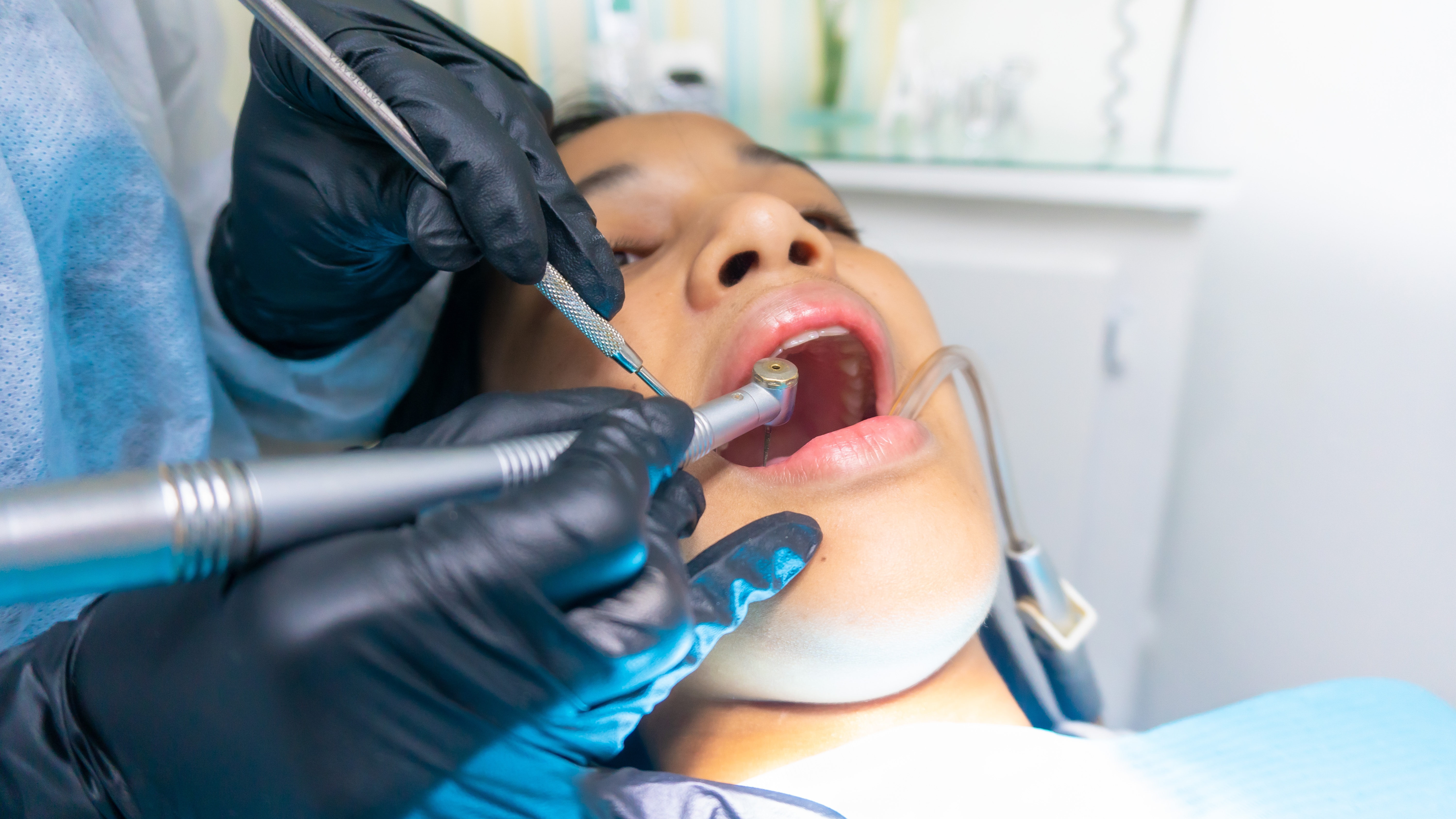 Couronne dentaire : quelle prise en charge des mutuelles santé ?