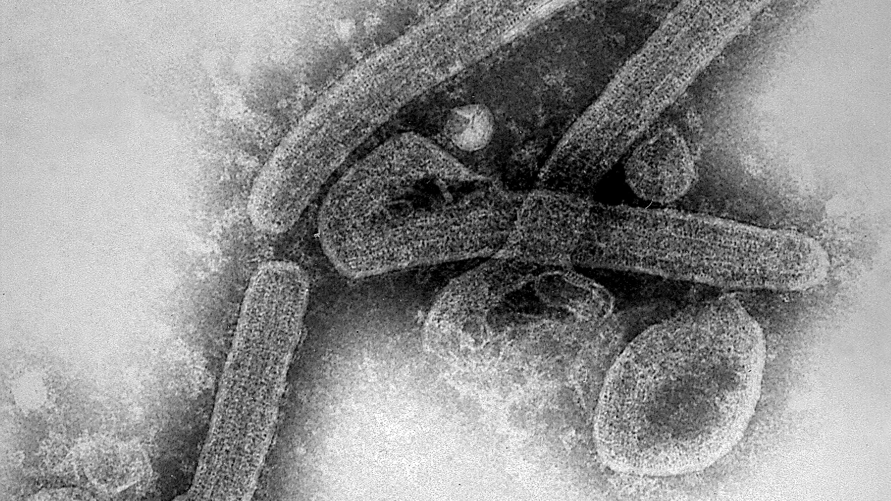 Symptome der Ebola Virus Erkrankung