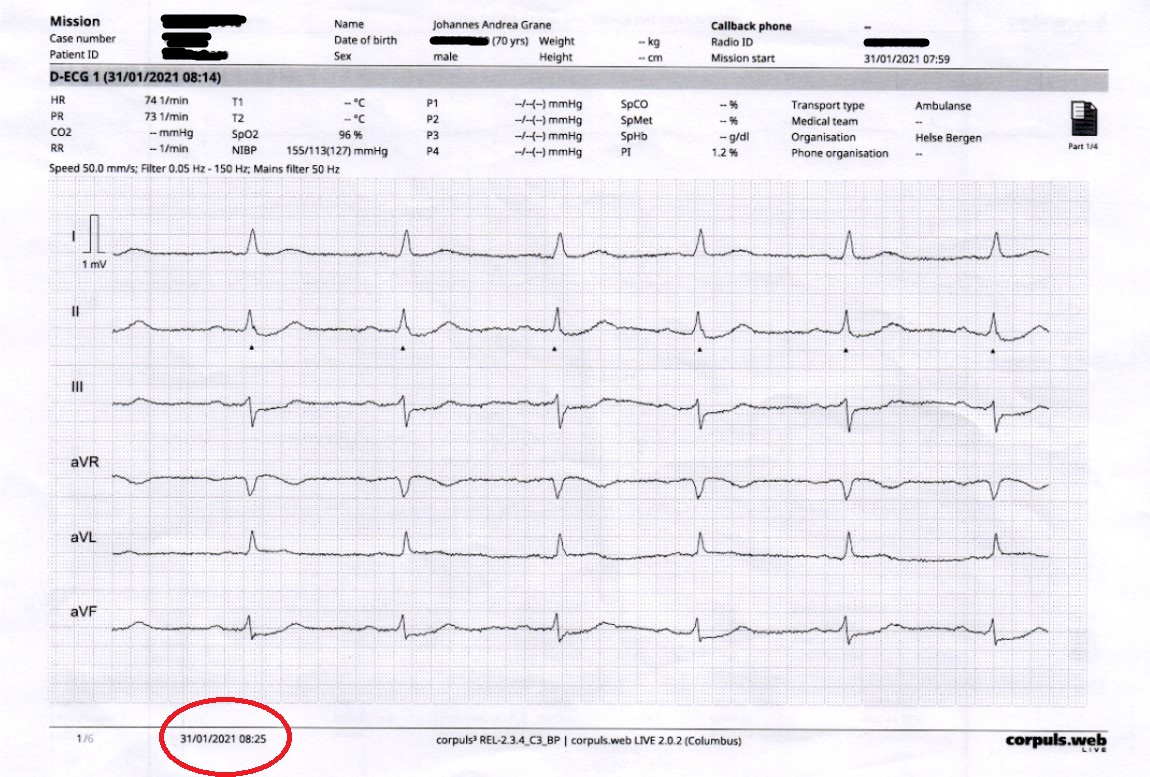 EKG'en ble utskrevet klokken 08.25 på sykehuset. Det var 13 minutter før Johannes Grane ankom sykehuset.