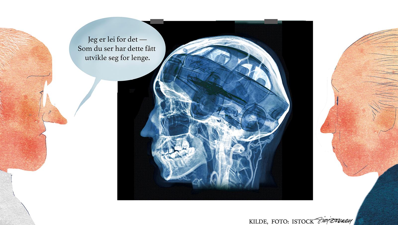 Skull x-ray image of Human skull Lateral mix MRV Brain image showing Venous sinuses of brain in skull.