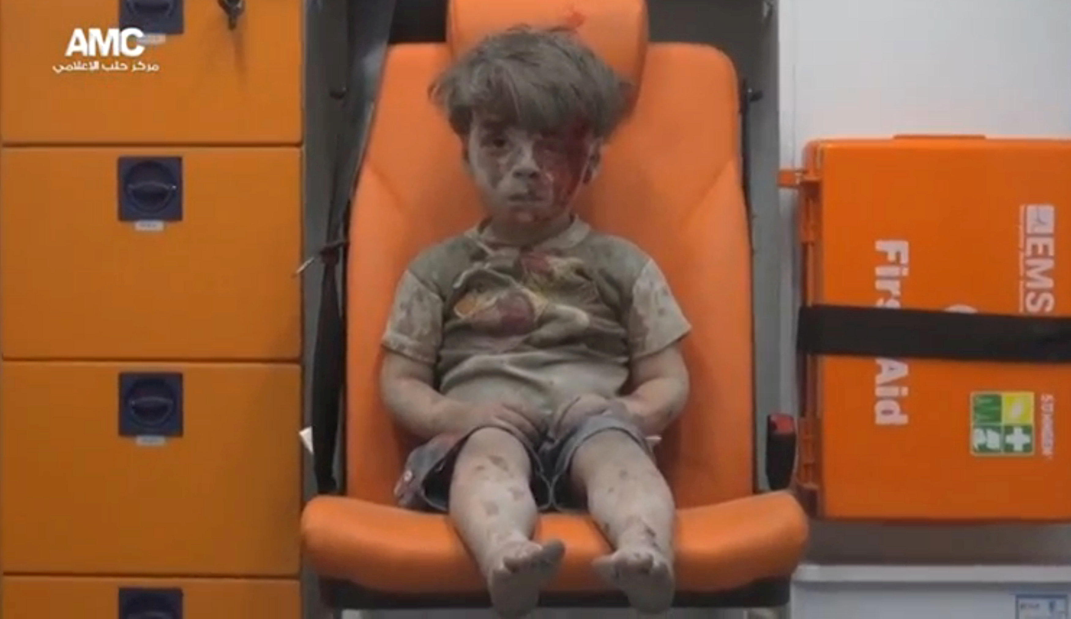 Omran: Bildet av Omran Daqneesh dekket av blod og støv, vekker reaksjoner over hele verden. 