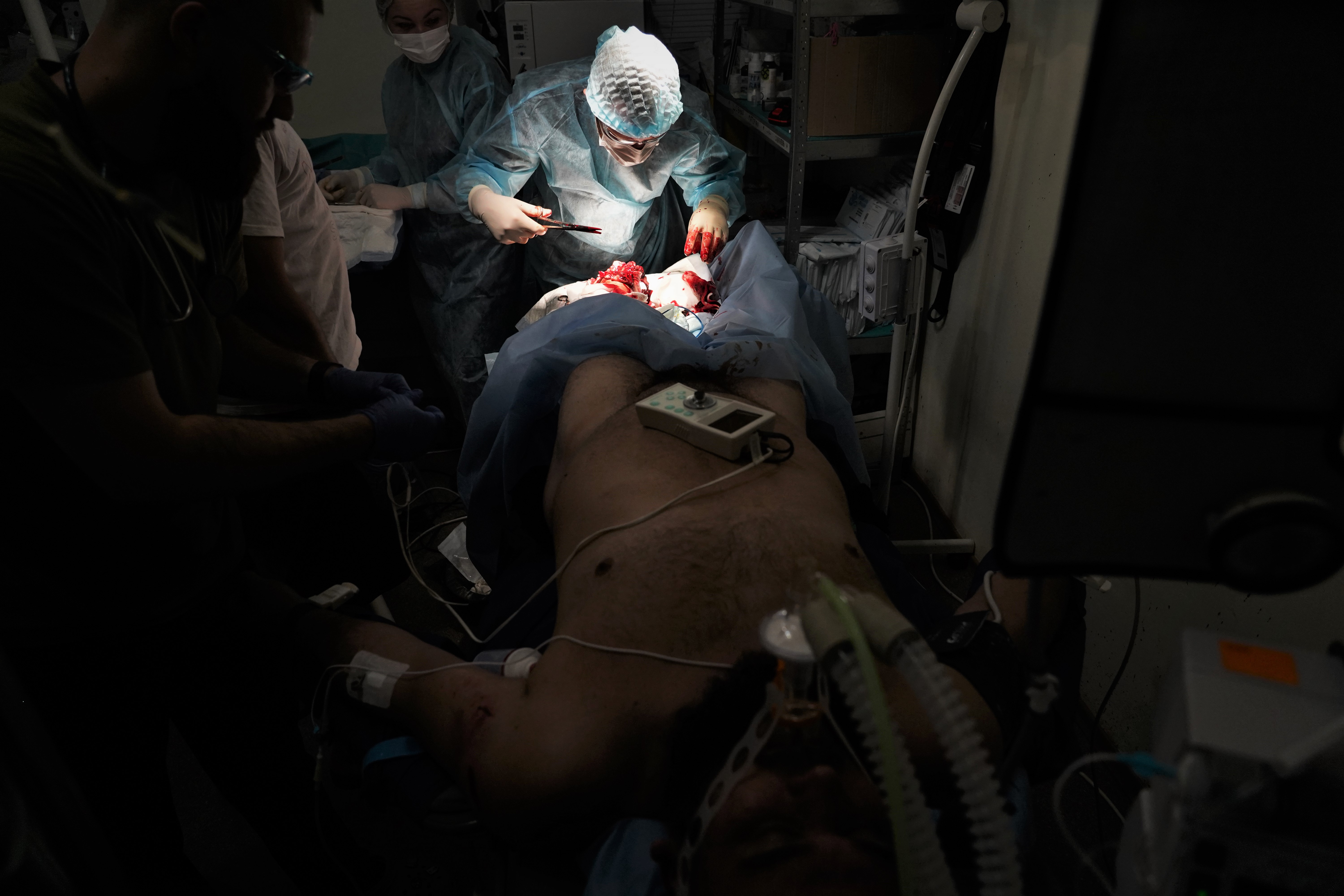 Um soldado amputado ao pisar em uma mina é operado na sala de cirurgia.