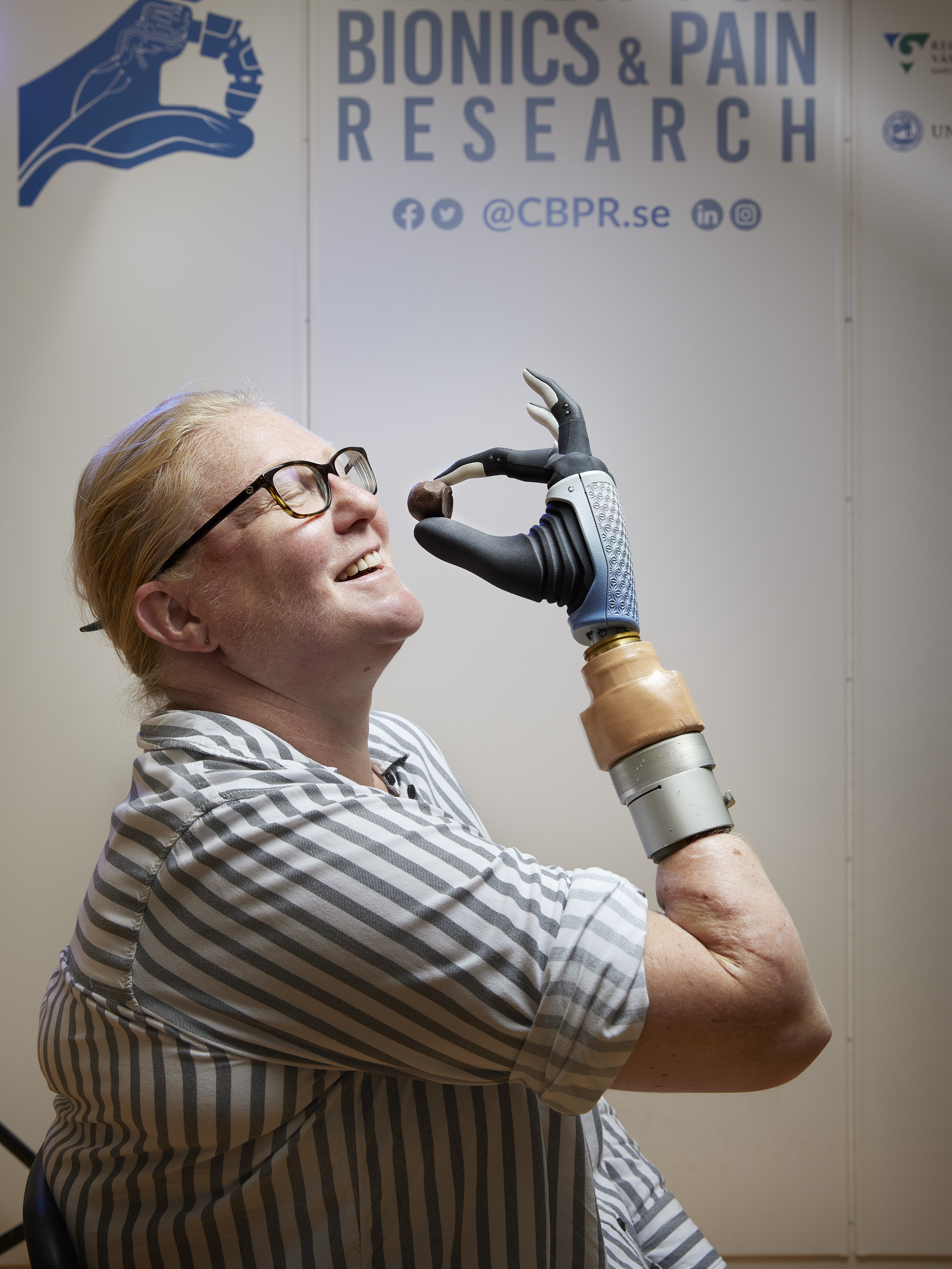 Three years of living with a bionic hand: 'This research has given