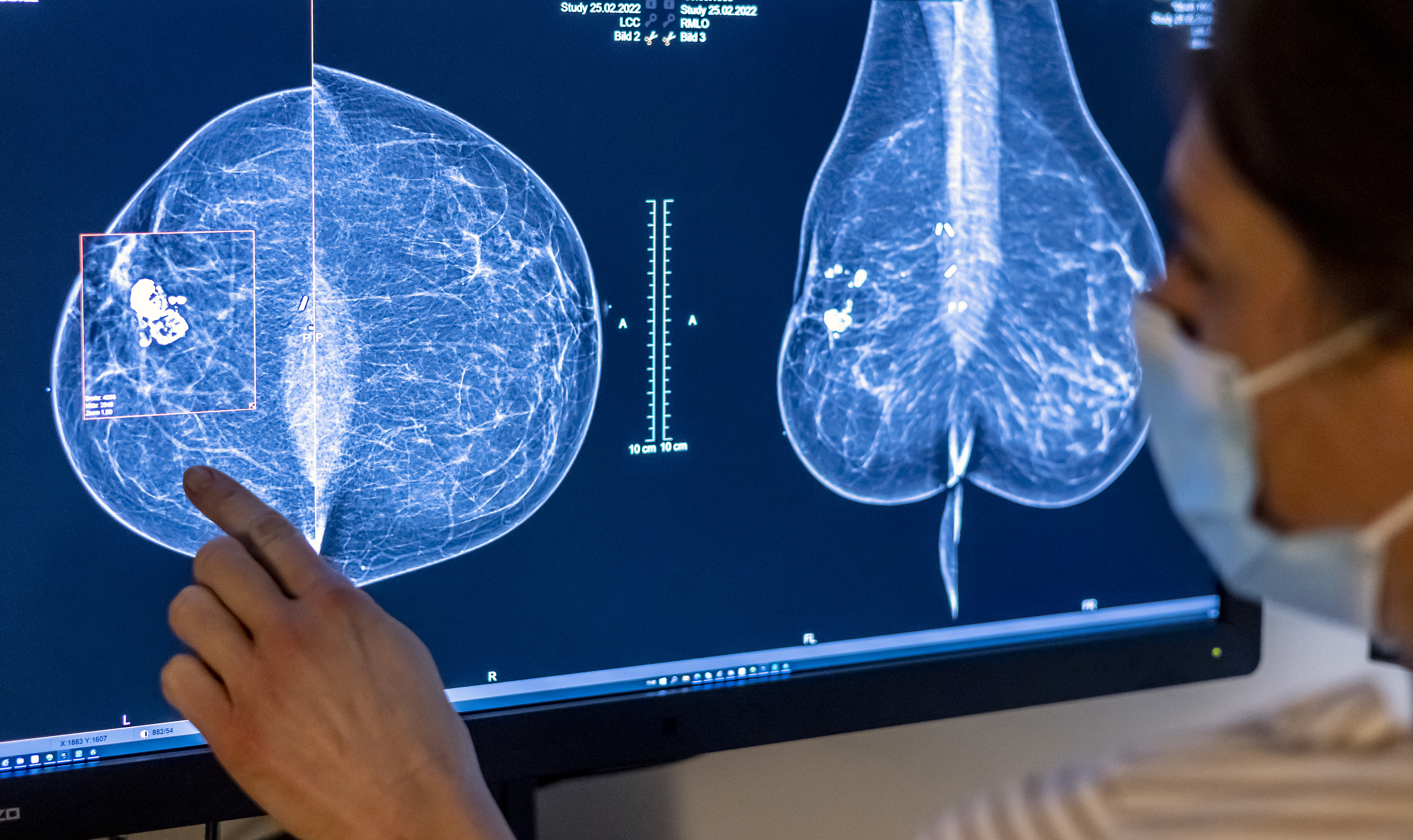 Personal sanitario analiza una mamografía en un hospital de Berlín, Alemania.