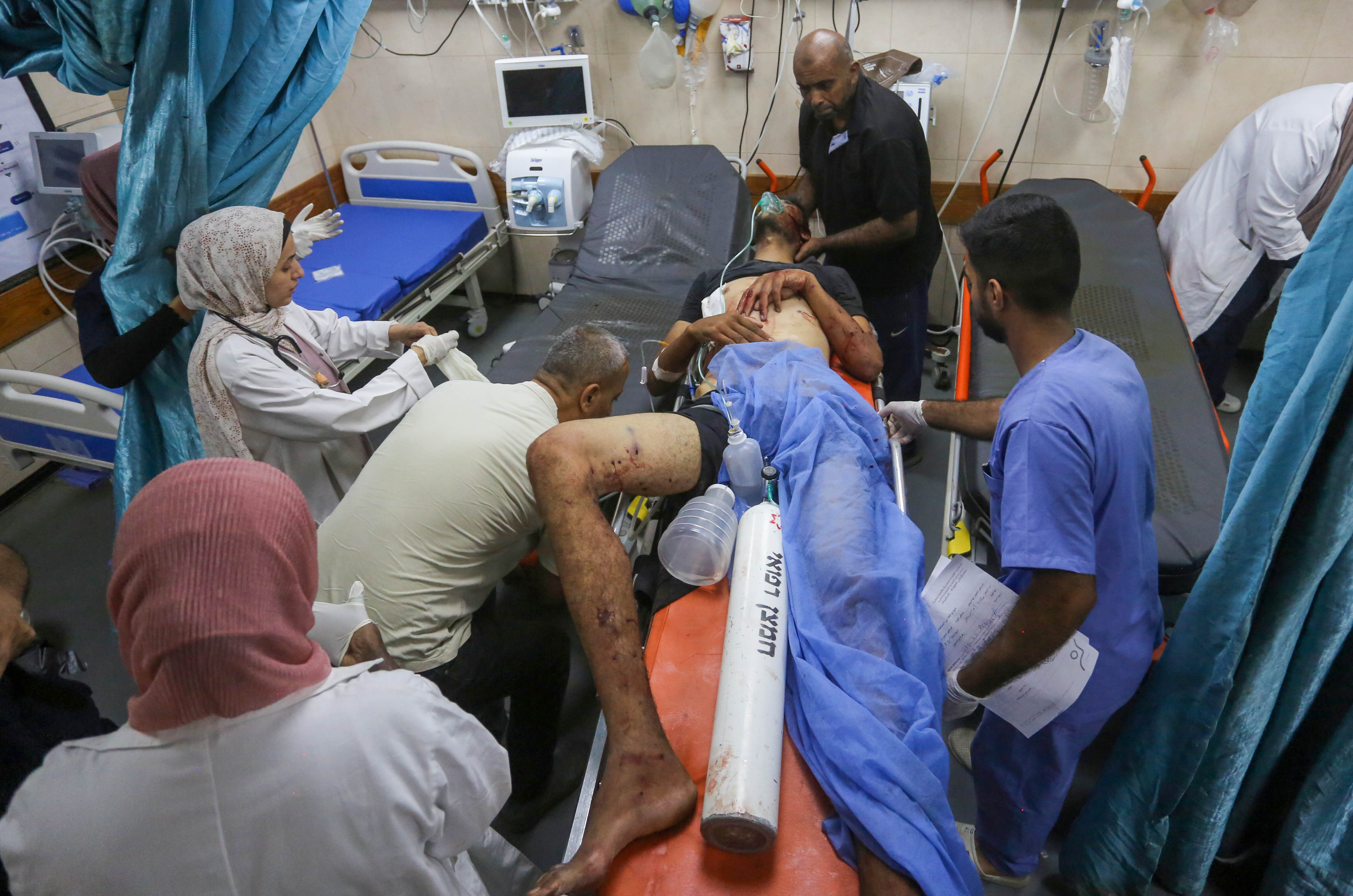DEIR AL-BALAH, GAZA - AUGUST 05: Palestinians wounded in Israeli attack on Nuseirat refugee camp are brought to al-Aqsa Martyrs Hospital for treatment in Deir al-Balah, Gaza on August 05, 2024. (Photo by Ashraf Amra/Anadolu via Getty Images)