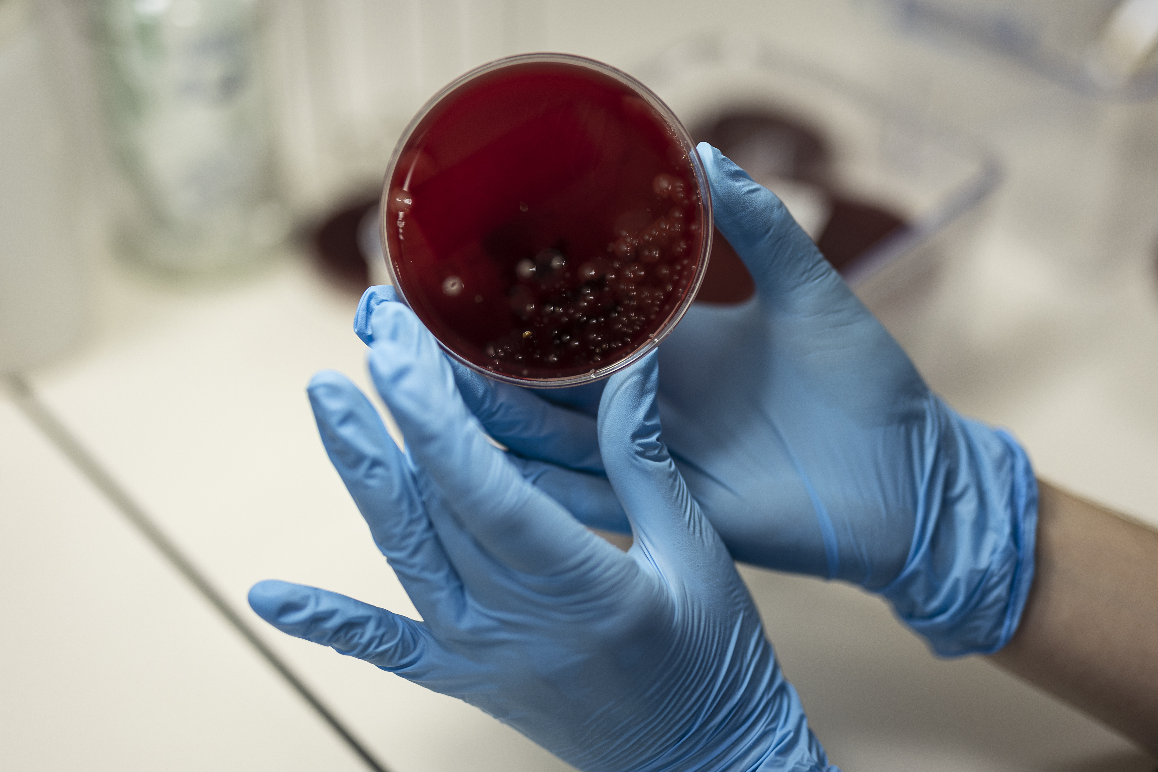 Un cultivo de 'Clostridioides difficile' en el laboratorio del servicio de microbiología del Hospital de Bellvitge. 
