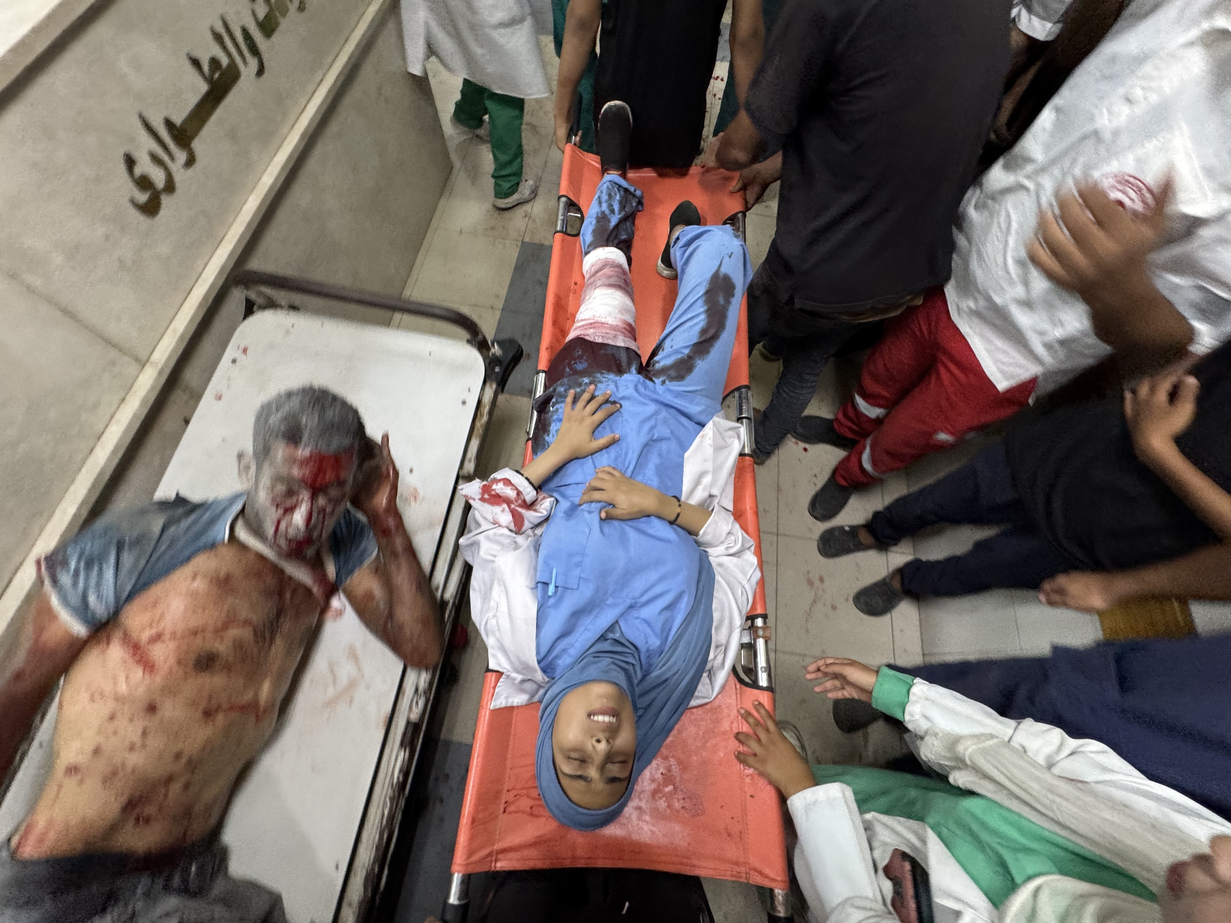Una trabajadora sanitaria herida tras un ataque israelí contra el hospital Nasser, en Jan Yunis, en el sur de Gaza, este lunes 25 de agosto.