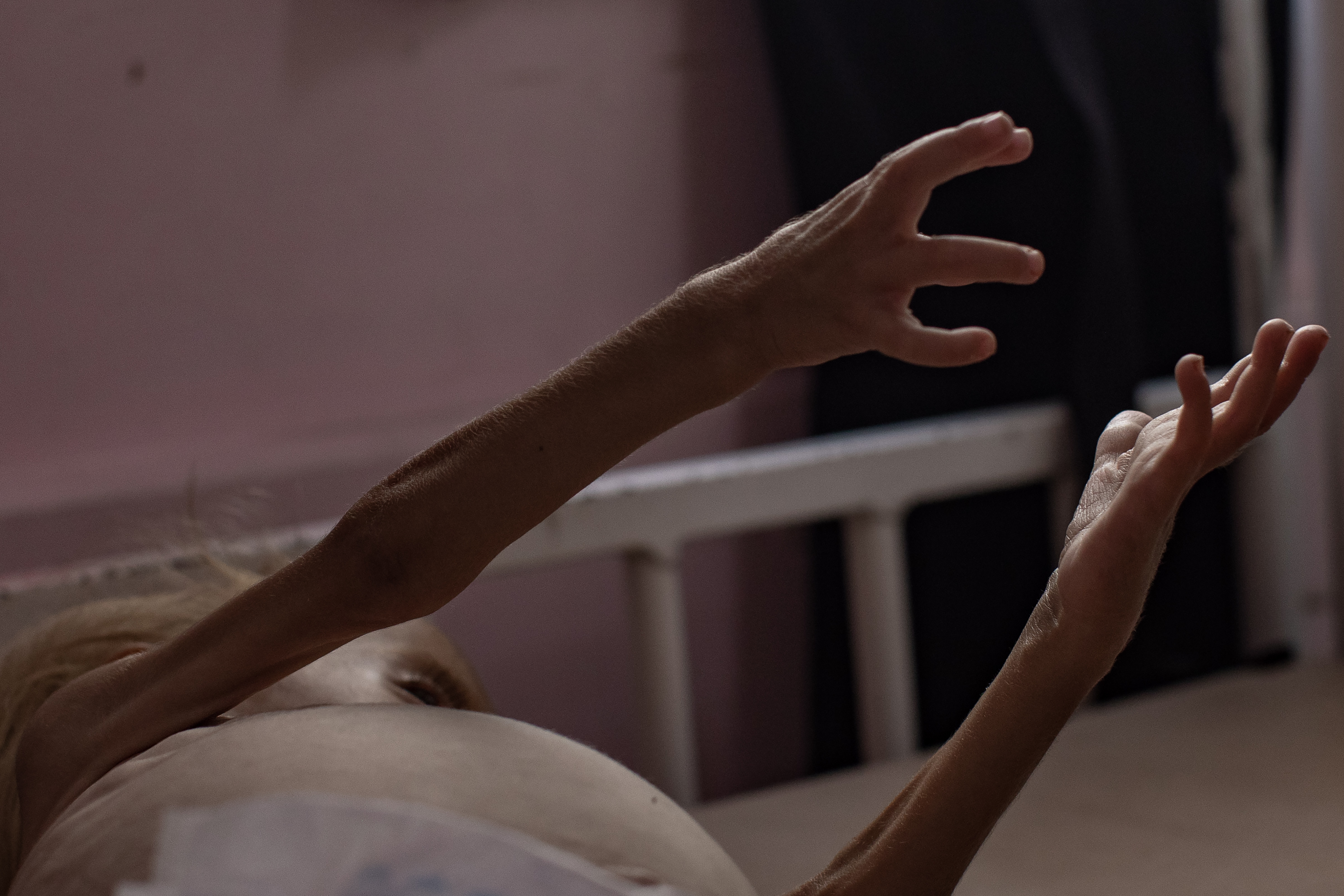 Un niño con desnutrición aguda alza sus brazos en el hospital Nasser, en Jan Yunis, al sur de la Franja, el 10 de agosto de 2025.