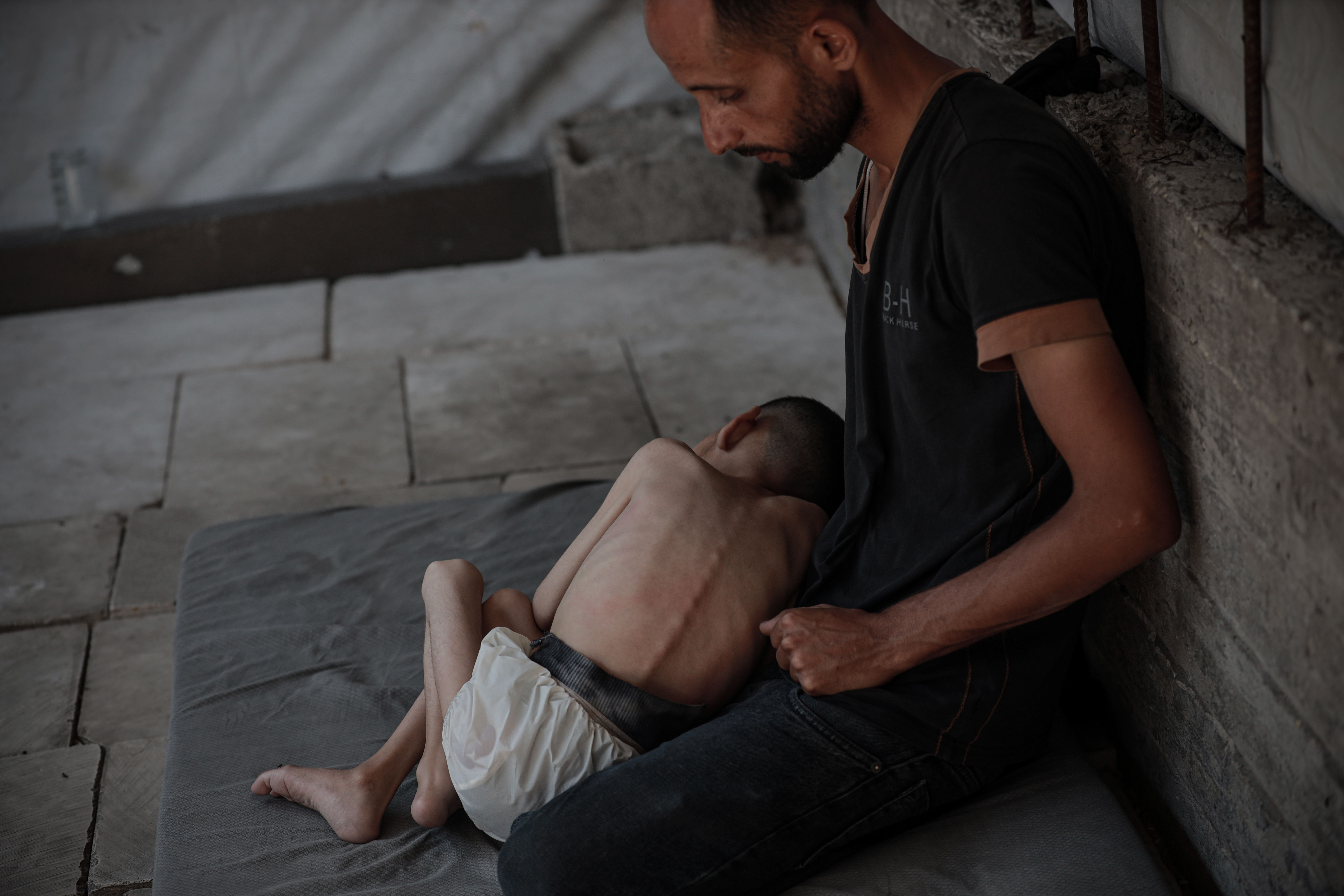 Un niño con desnutrición severa con su padre en una tienda de campaña en un campamento de refugiados en el oeste de Gaza, el domingo 27 de julio de 2025.