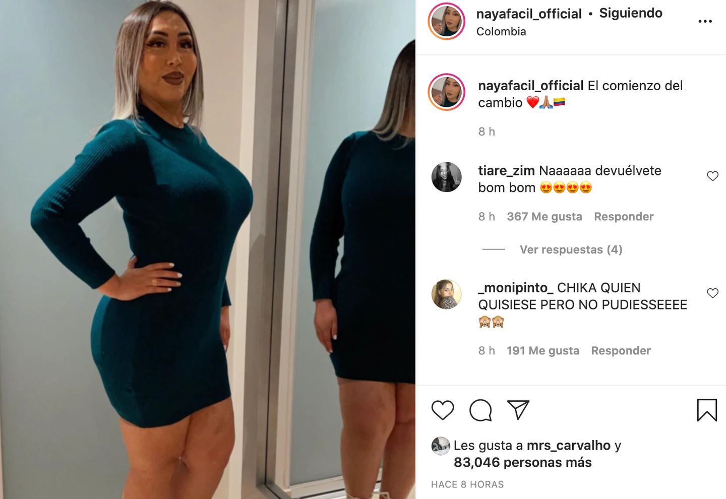 Cómo quedó Naya Fácil tras sus siete operaciones? Influencer compartió  primeras fotos tras cirugías | Actualidad | LOS40 Chile