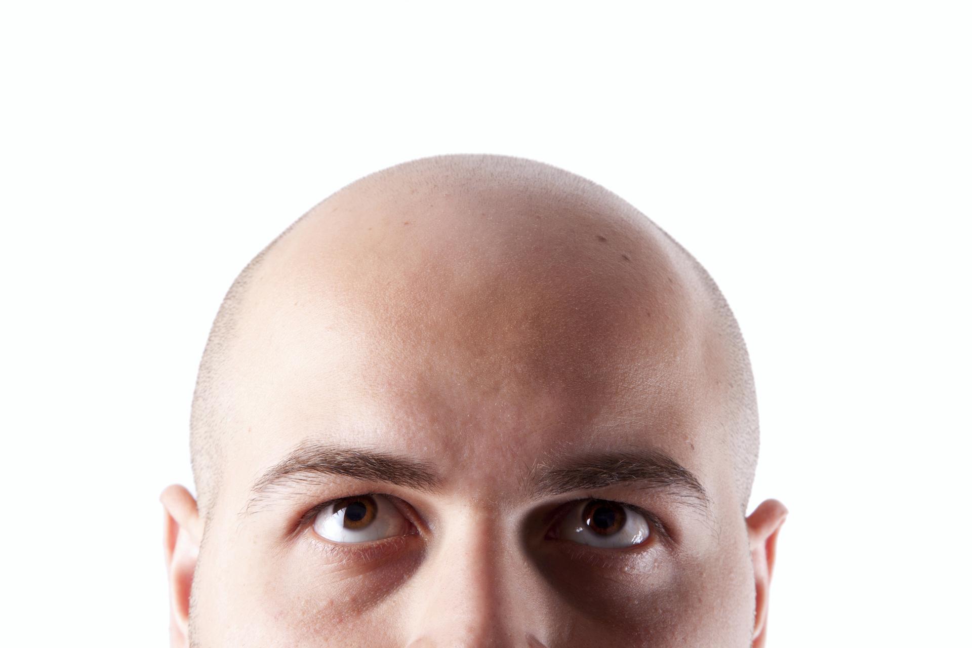 Dubai-based trichologist Lars Skjøth on how to reverse hair loss